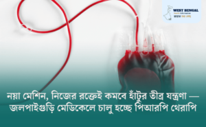 PRP Therapy at Jalpaiguri Medical College for Knee Osteoarthritis Pain